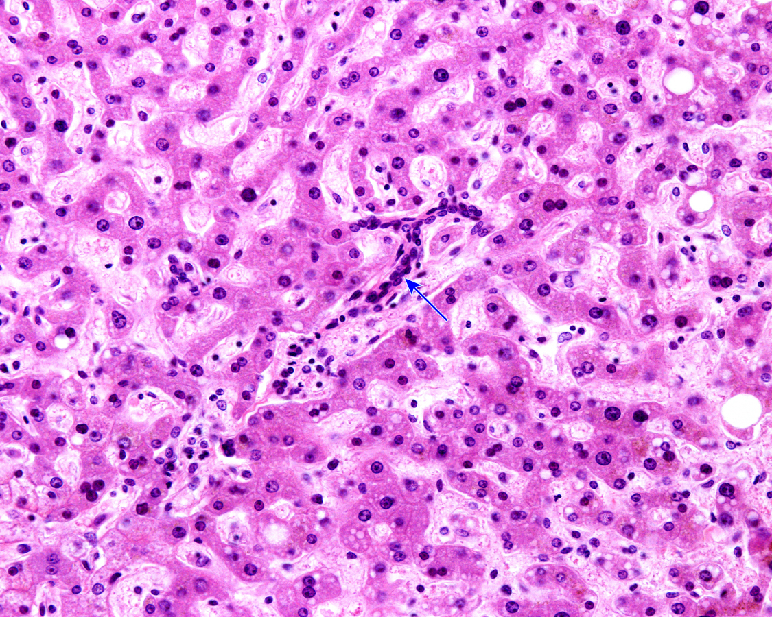 Histologia Higado 4602